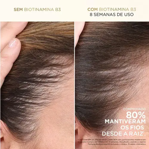 CR P/PENTEAR PANTENE BIOTINAMINA 240 GR